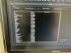 SAMSUNG WS80A Elite Ultrasound - OB / GYN