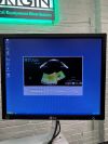 OPTOVUE RTVue OCT Scanner w/ Computer & Cart OCT