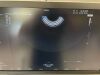 SAMSUNG Hera W9 Ultrasound