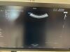 SAMSUNG Hera W9 Ultrasound
