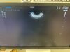 SAMSUNG RS85 Ultrasound - OB / GYN - Vascular