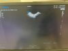 SAMSUNG RS85 Ultrasound - OB / GYN - Vascular
