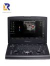 GE Versana Active Plus ultrasound system