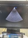 SAMSUNG PE2-4 Ultrasound Transducer