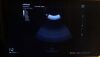 MINDRAY SD8-1 Ultrasound Transducer