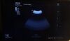 MINDRAY SD8-1 Ultrasound Transducer