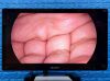 STRYKER 1688 4K 1688010000 Full Lap/Arthro tower 1688 4K Surgical Tower