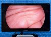 STRYKER 1688 4K 1688010000 Full Lap/Arthro tower 1688 4K Surgical Tower