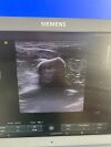 SIEMENS ACUSON X700 Ultrasound System