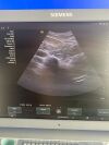 SIEMENS ACUSON X700 Ultrasound System