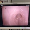 PENTAX ED-3680TK Duodenoscope