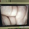 PENTAX ED-3680TK Duodenoscope