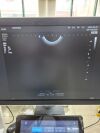 SAMSUNG EVN4-9 Ultrasound Transducer
