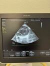 PHILIPS S4-1 Ultrasound Transducer