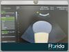 GE LOGIQ S8 R2 BT14 ULTRASOUND SYSTEM WITH TRANSDUCER PROBE S1-5 CARDIAC