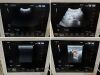 HITACHI HI VISION Avius Ultrasound - Cardiac - Vascular