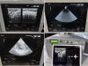 HITACHI HI VISION Avius Ultrasound - Cardiac - Vascular