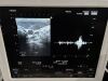 HITACHI HI VISION Avius Ultrasound - Cardiac - Vascular