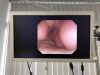 OLYMPUS PCF-Q260AI Colonoscope
