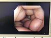 OLYMPUS PCF-H290ZI Colonoscope