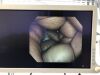 OLYMPUS PCF-H290ZI Colonoscope