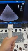 MINDRAY P8-2s Ultrasound Transducer