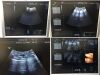 GE Voluson E8 Ultrasound - OB / GYN
