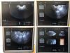 GE Voluson E8 Ultrasound - OB / GYN