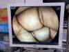 FUJI LASEREO VP-4450HD, LL-4450, XL-4450 Endoscope Video System