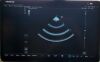 MINDRAY TE Air i3P Ultrasound Transducer