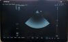 MINDRAY TE Air i3P Ultrasound Transducer