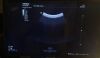 MINDRAY C5-1 Ultrasound Transducer