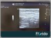 GE LOGIQ E9 2014 GE LOGIQ E9 REF:5205000-7 SOFTWARE VERSION R5 REV.1.3 WITH TRANSDUCER PROBE L8-18i