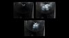 GE VOLUSON S8 Ultrasound - OB / GYN
