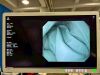 OLYMPUS GIF-H290 Endoscope