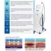 AGEJET  USA Non-Invasive Laser Treatment for Skin Rejuvenation Tightening Resurfacing Best Oxygen Jet Product Laser - Radio Frequency (
