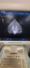 ESAOTE PA230E Ultrasound Transducer
