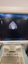 ESAOTE PA230E Ultrasound Transducer