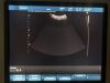 PHILIPS V7-3 Ultrasound Transducer