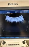 PHILIPS V7-3 Ultrasound Transducer