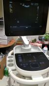 PHILIPS SPARQ Ultrasound - OB / GYN - Vascular
