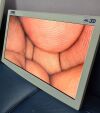 KARL STORZ TM350 4K 3D 32 inch Monitor