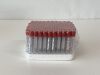BD Pack of 100 Serum Blood Collection Tubes  367815   Exp.2024-01  (AA1) Serum Blood Collection Tubes