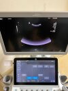 SIEMENS/ACUSON Acuson Sequoia Diagnostic Ultrasound System