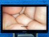 STRYKER 1688 4K Tower  Lcd Monitor 4k 32” YOM: 2020 Laparoscope