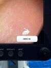 STRYKER 1688 4K Tower  Lcd Monitor 4k 32” YOM: 2020 Laparoscope