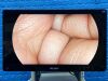 STRYKER 1688 4K Tower  Lcd Monitor 4k 32” YOM: 2020 Laparoscope