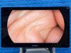 STRYKER 1688 4K Tower  Lcd Monitor 4k 32” YOM: 2020 Laparoscope