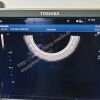 TOSHIBA PVT-781VTE PVT-781VTE Endocavity Ultrasound Probe for Aplio 300400500 Used Ultrasound General