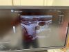 GE HEALTHCARE L2-9-D Ultrasound Transducer